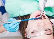 Millennials would rather go to the dentist than listen to a credit union sales pitch