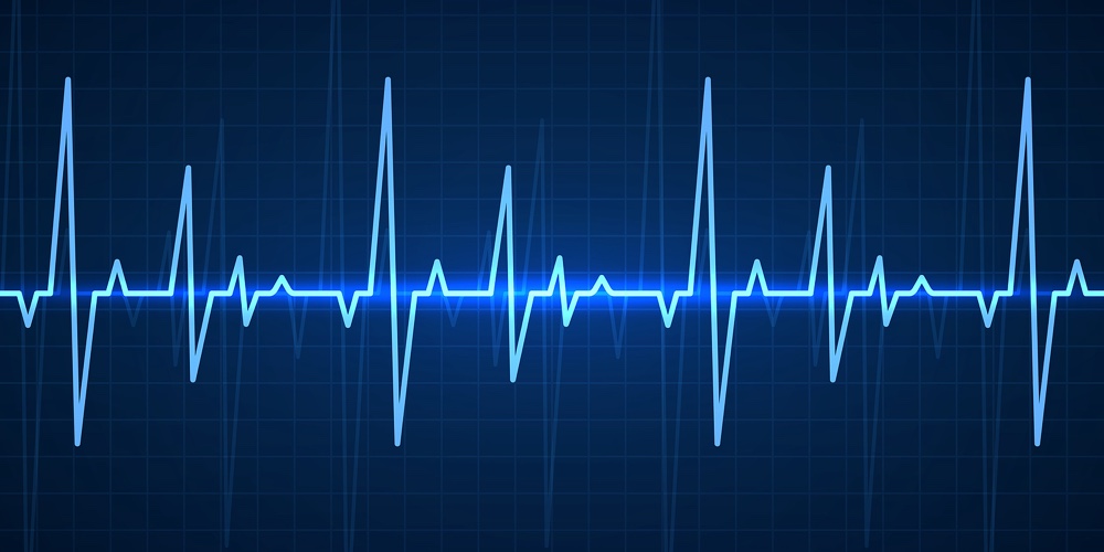 Ekg. Blue Sinusoidal Pulse Lines
