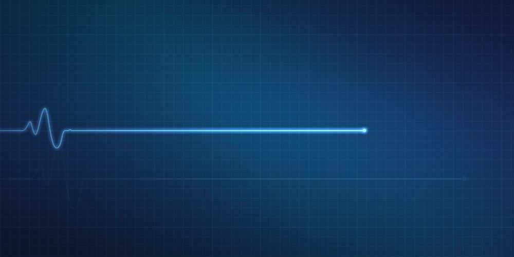 bigstock-Flatline-Heart-Monitor-55182362